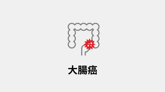 大腸がん