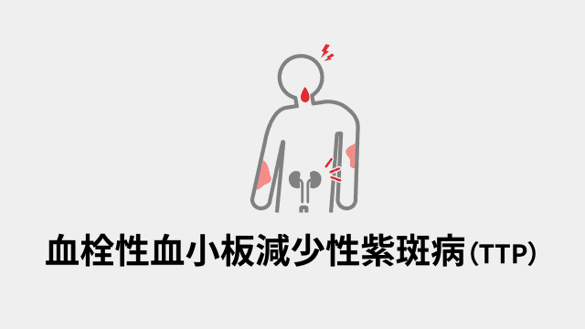 血栓性血小板減少性紫斑病（TTP）
