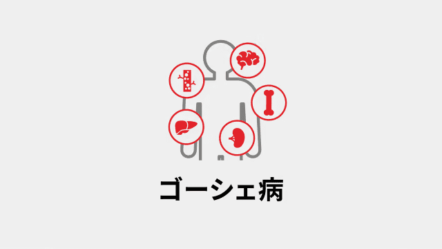 ゴーシェ病