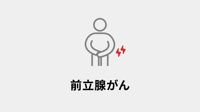 前立腺がん