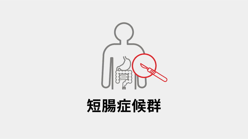 短腸症候群