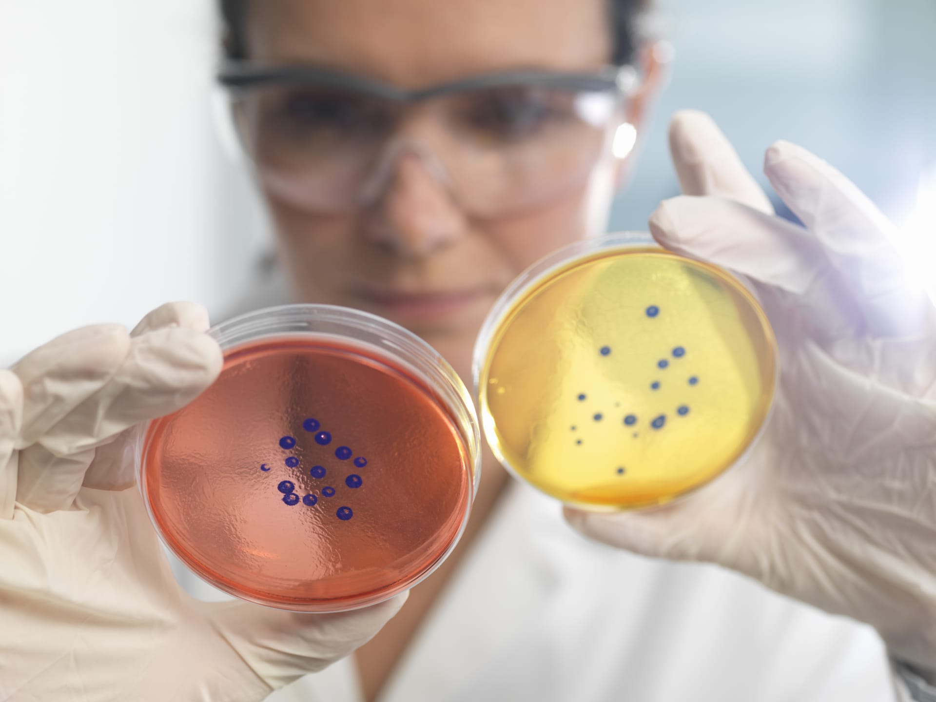 a lab employee looking at two agar plates